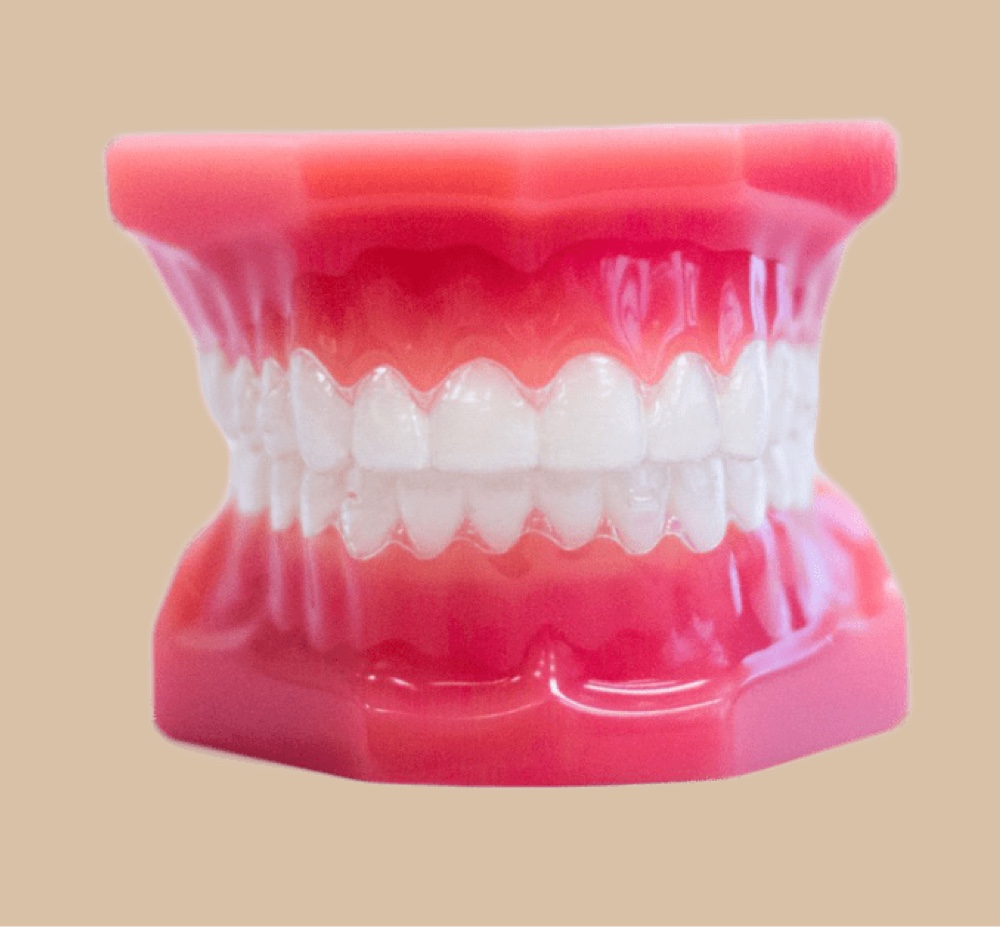 clear aligners on plastic model